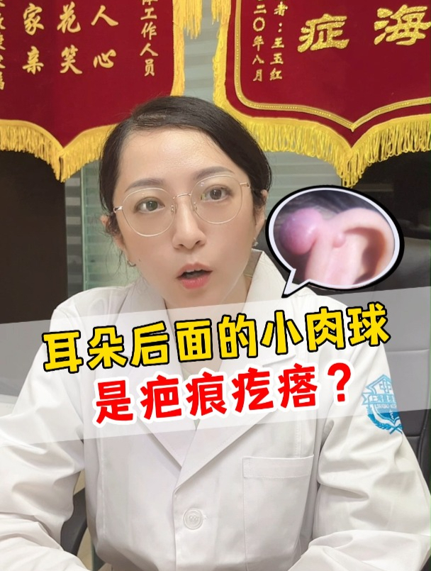 耳朵后面的小肉球是疤痕疙瘩吗?