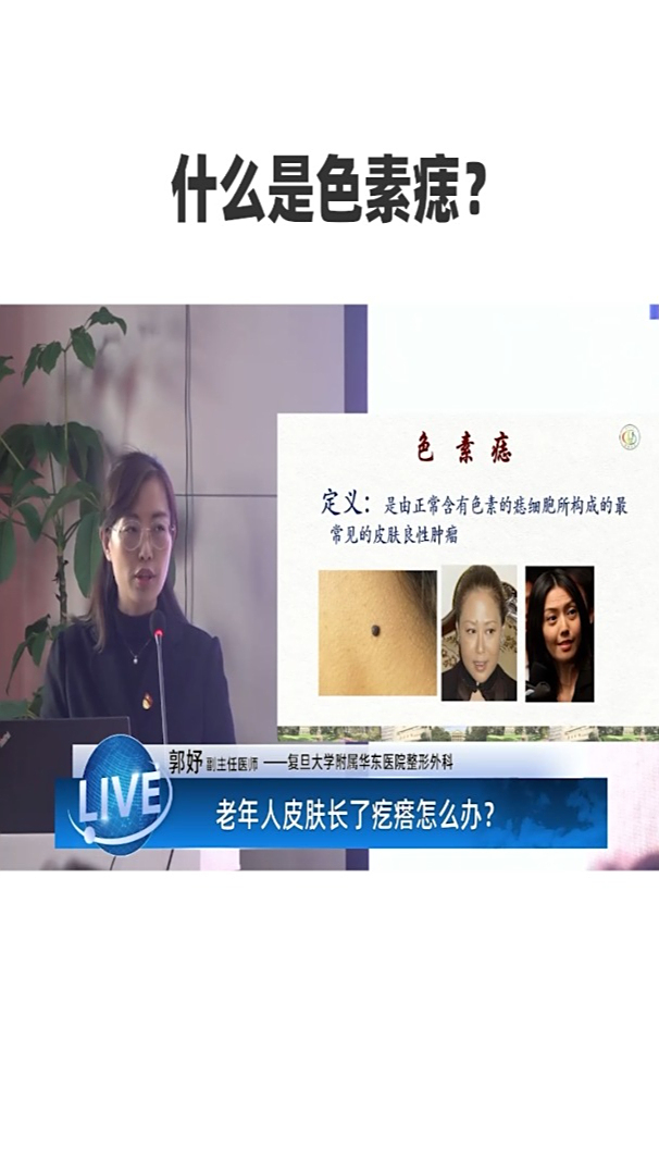   什么是色素痣?