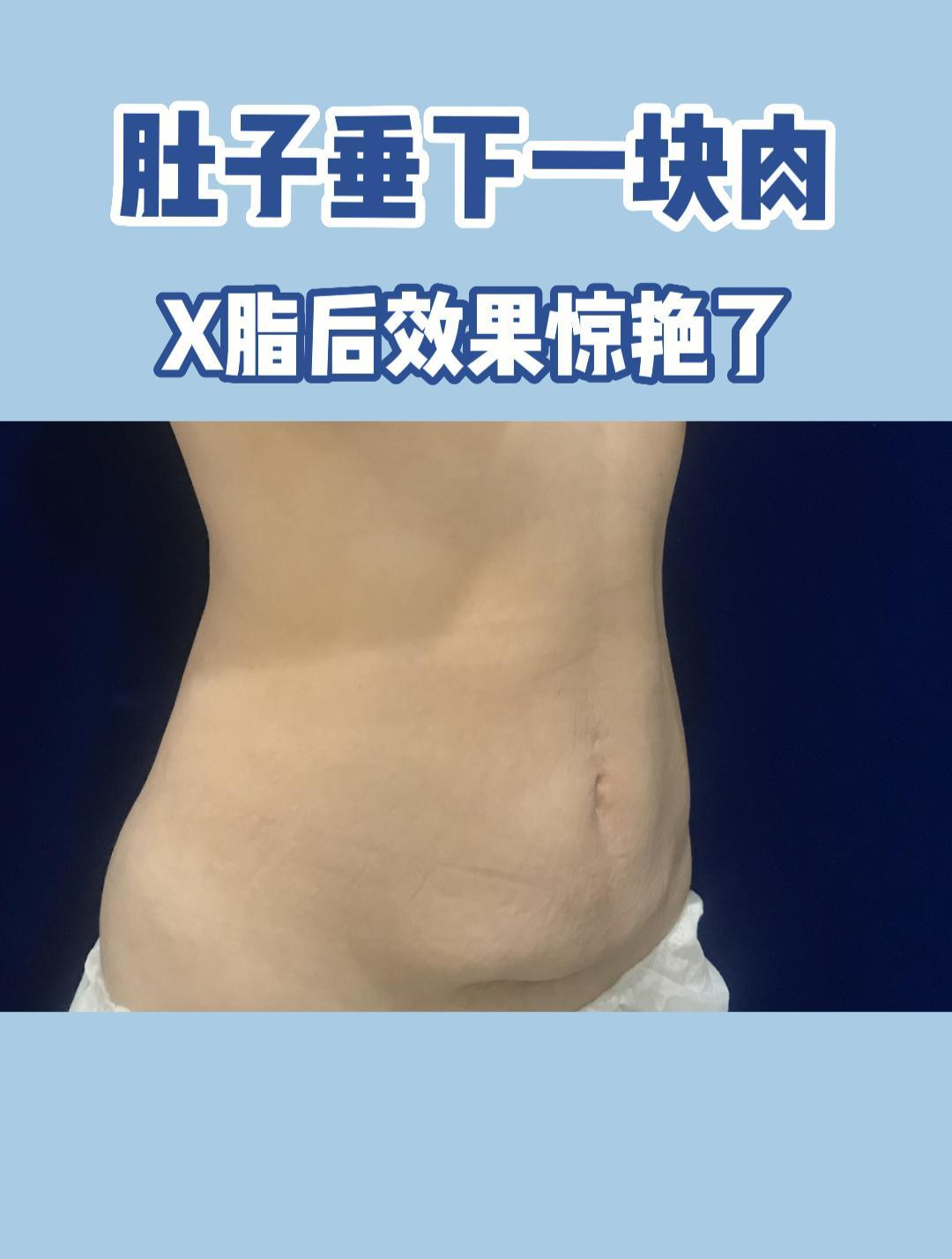如何快速解决肚子上的赘肉