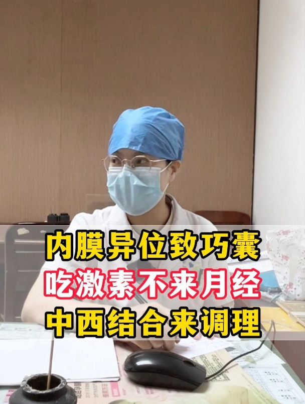 卵巢巧克力囊肿是子宫内膜异位症的一种病变,会随着月经来潮增大