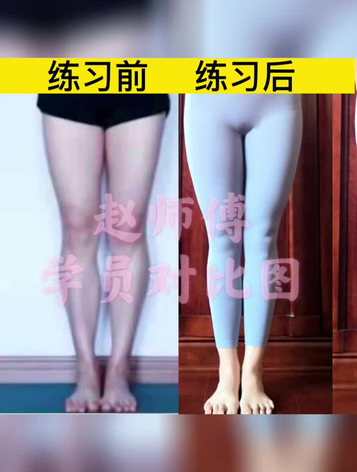 脚脖粗,小腿肌肉凸出练这套腿