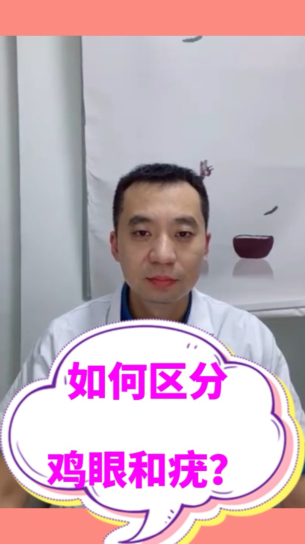 鸡眼和疣有哪些治疗方法?医生:首先要区分好鸡眼和疣