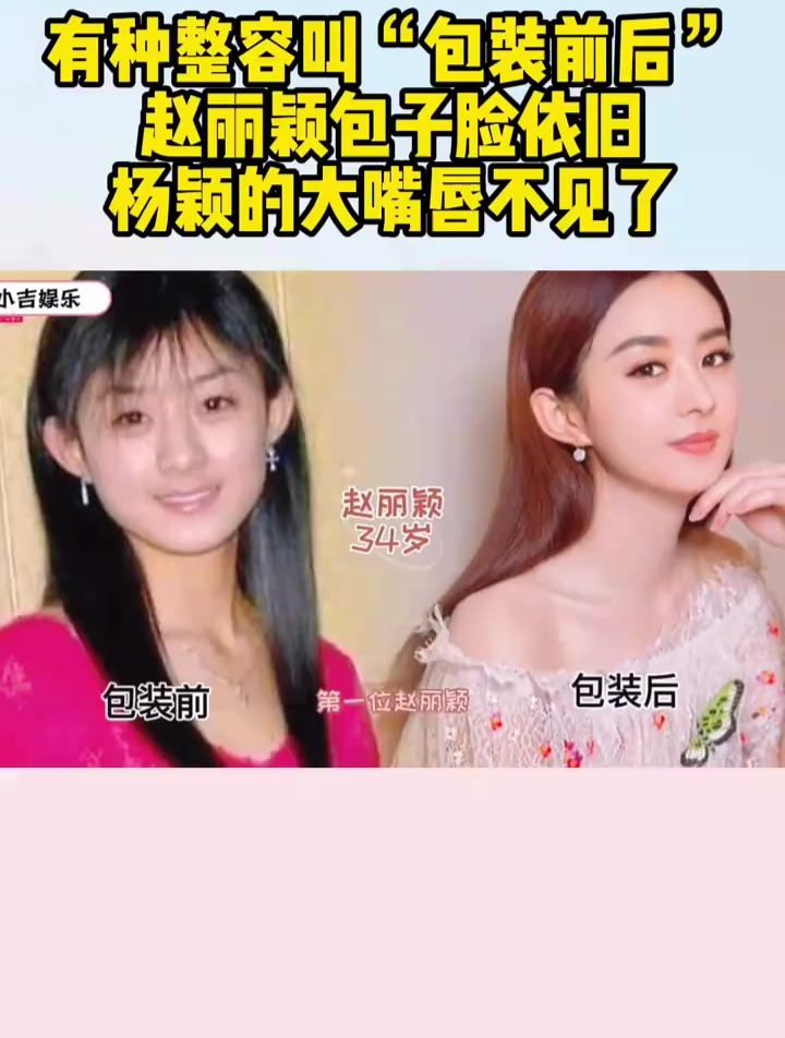 有种整容叫“包装前后”,赵丽颖包子脸依旧,杨颖的大嘴唇不见了