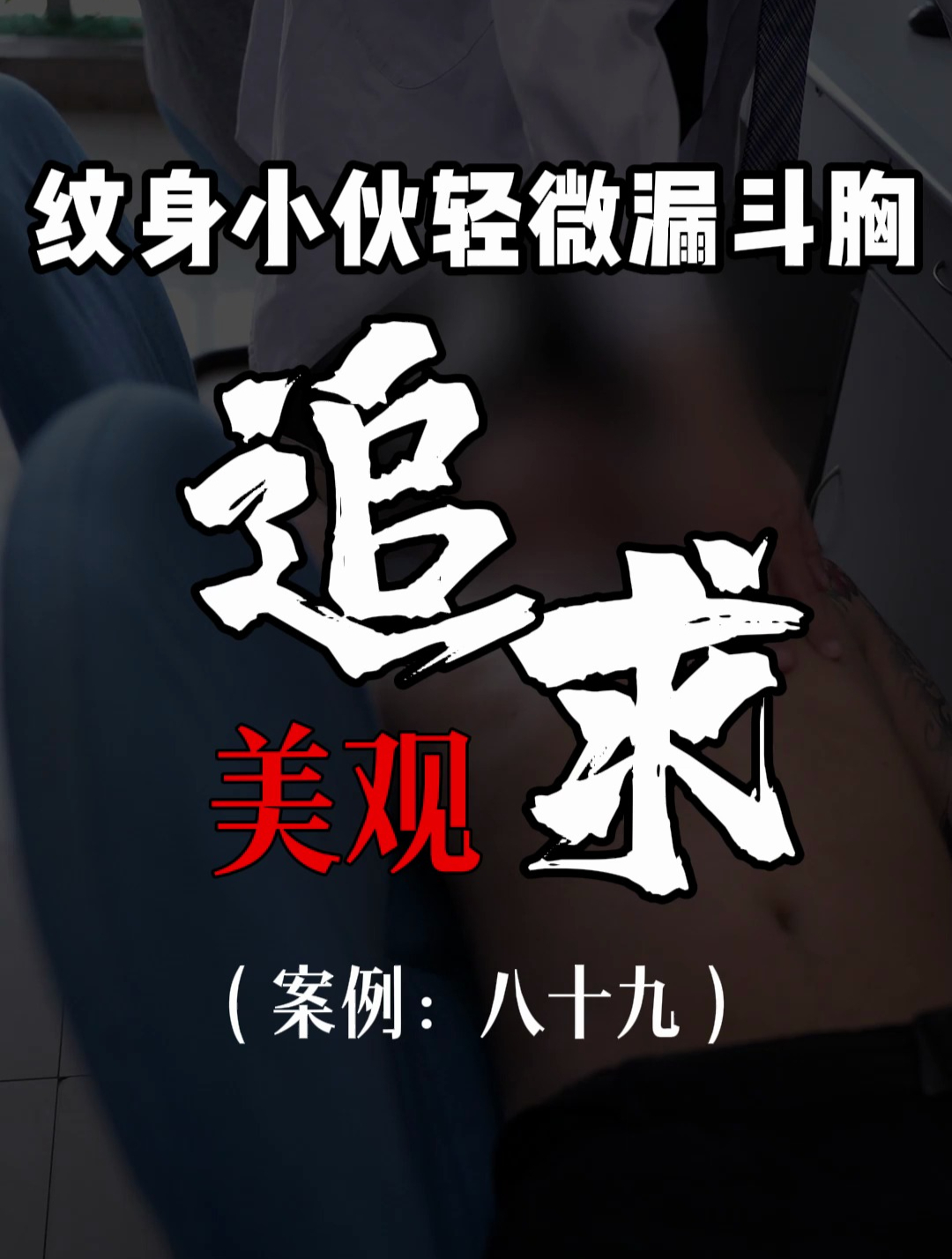 漏斗胸鸡胸医生张东升