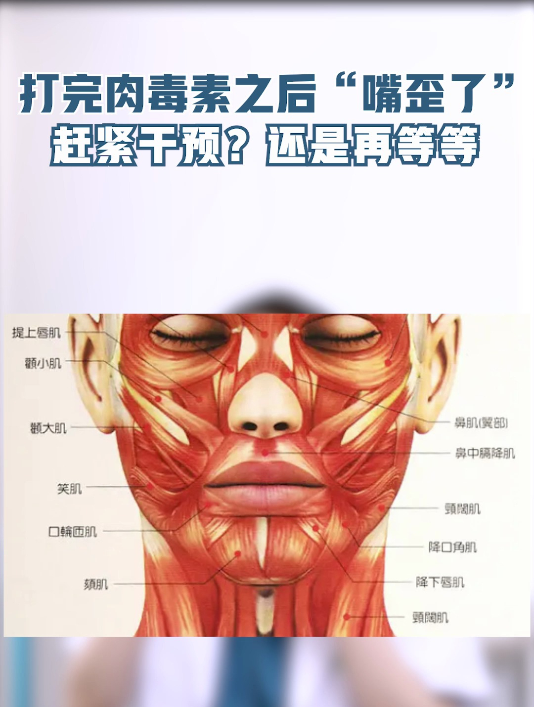 打完肉毒素后“嘴歪了”怎么办?
