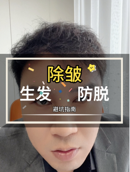 除皱生发!除皱还能生发?生发 脱发 养发护发