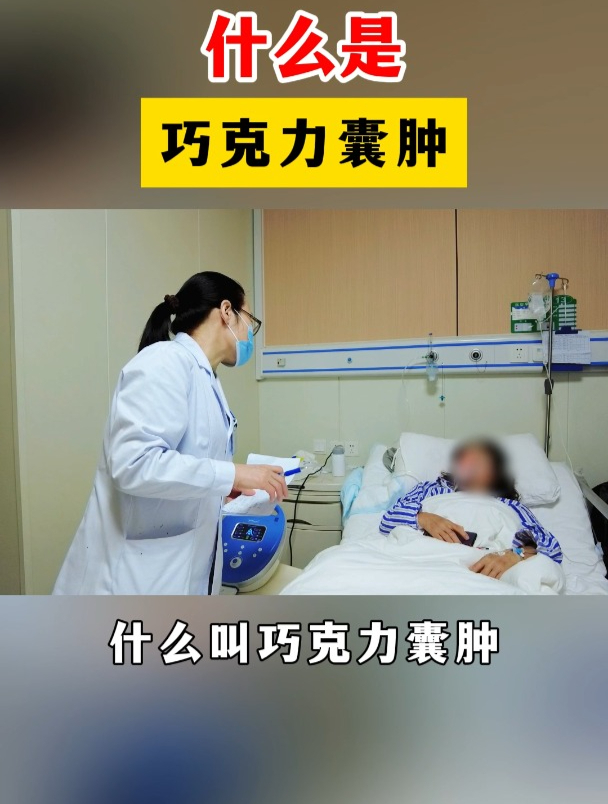 什么是巧克力囊肿?