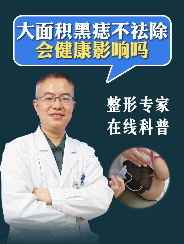 大面积黑痣不祛除会对健康有影响吗