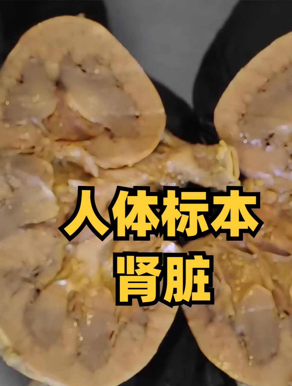 人体标本,肾脏的内部结构