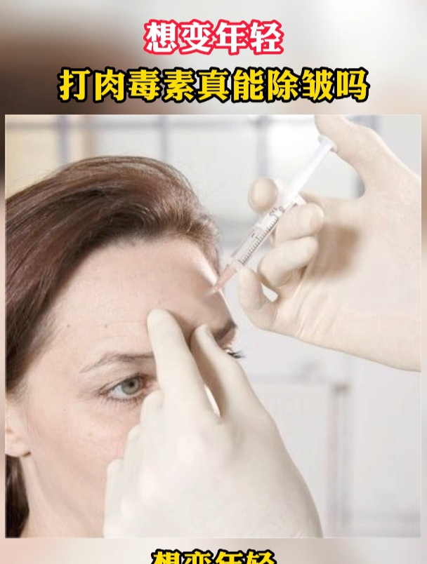 想变年轻,打肉毒素真能除皱吗