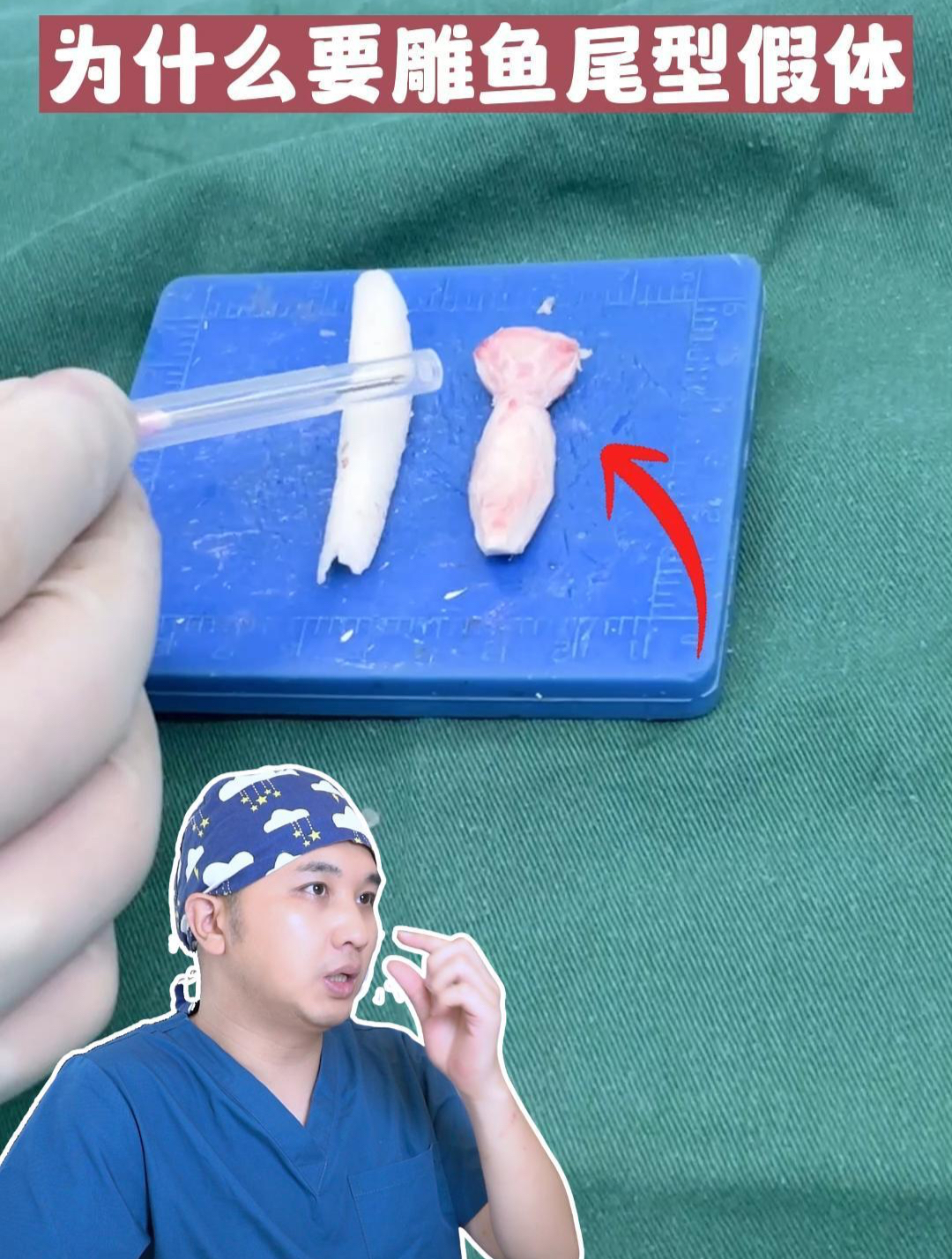 为什么要雕鱼尾型假体!