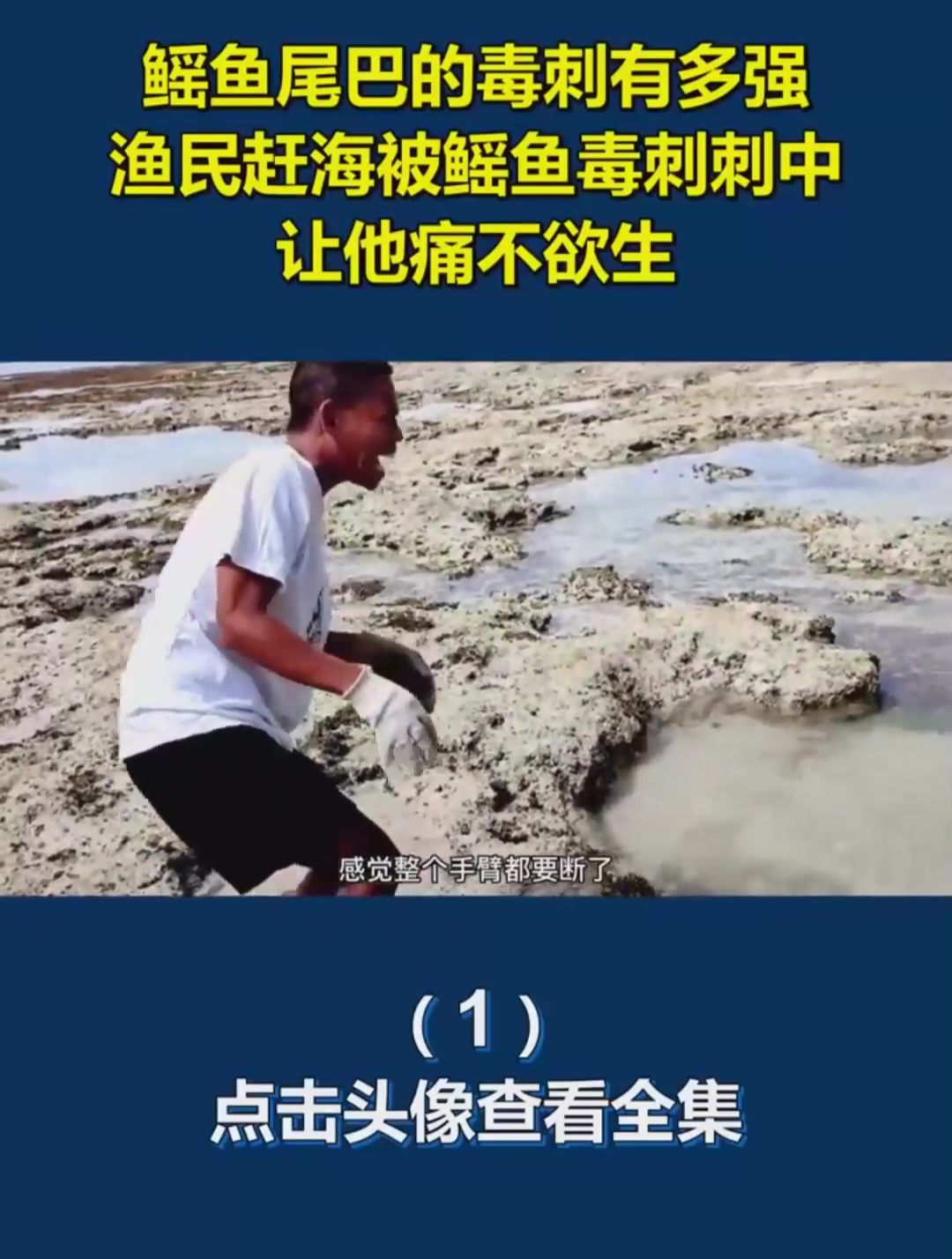 鳐鱼尾巴的毒刺有多强,渔民赶海被鳐鱼毒刺刺中,让他痛不欲生1