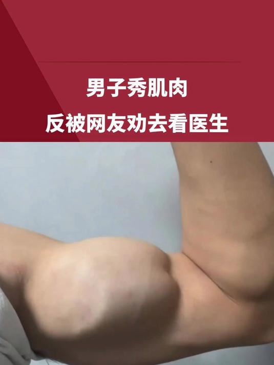 男子秀肌肉,反被网友劝去看医生