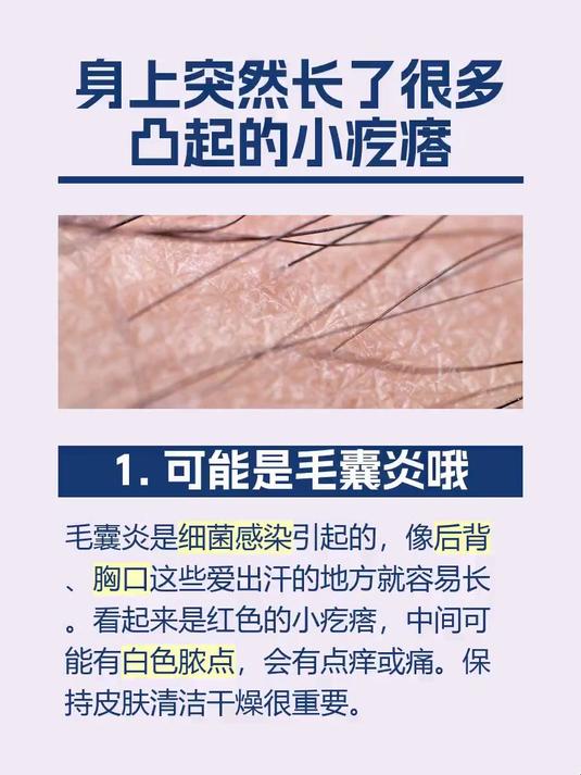 #马上健康过大年#身上突然长了很多凸起的小疙瘩