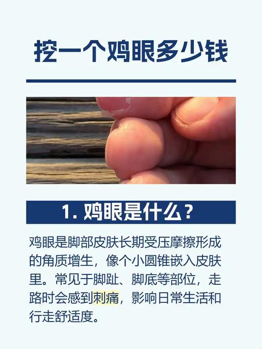 #马上健康过大年#挖一个鸡眼多少钱