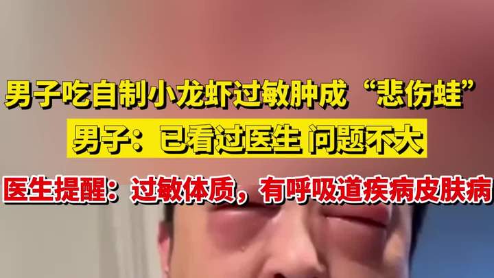 男子吃自制小龙虾过敏肿成“悲伤蛙”,男子:已看过医生问题不大