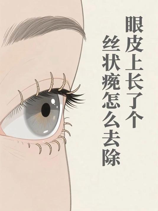 眼皮上长了个丝状疣怎么去除