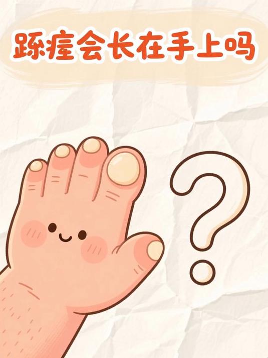 跖疣会长在手上吗 #健康扬帆季#