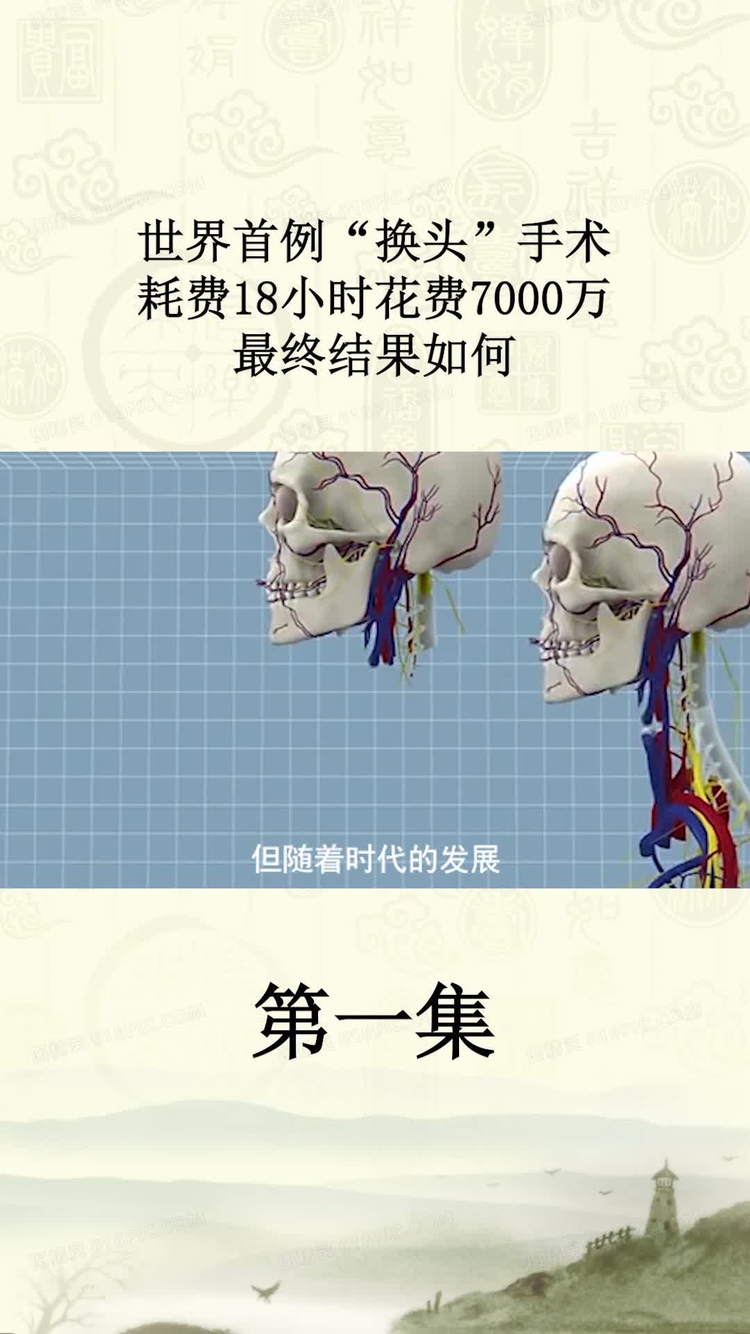 中国医生证实 人体换头手术成功 - Capital Asia Magazine 《资本》杂志