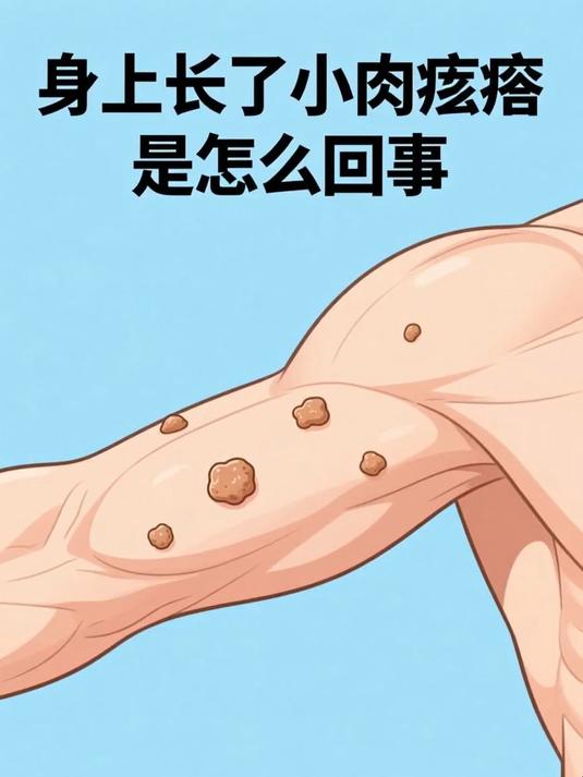 身上长了小肉疙瘩是怎么回事 #健康扬帆季#
