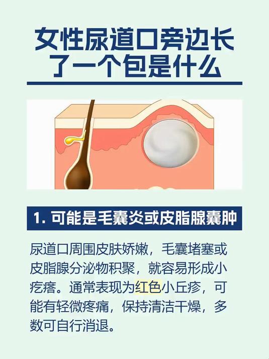 女性尿道口旁边长了一个包是什么