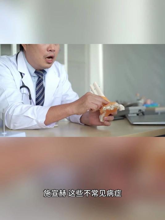 施宣赫老师说:探秘不常见病症:了解这些疾病,为健康护航