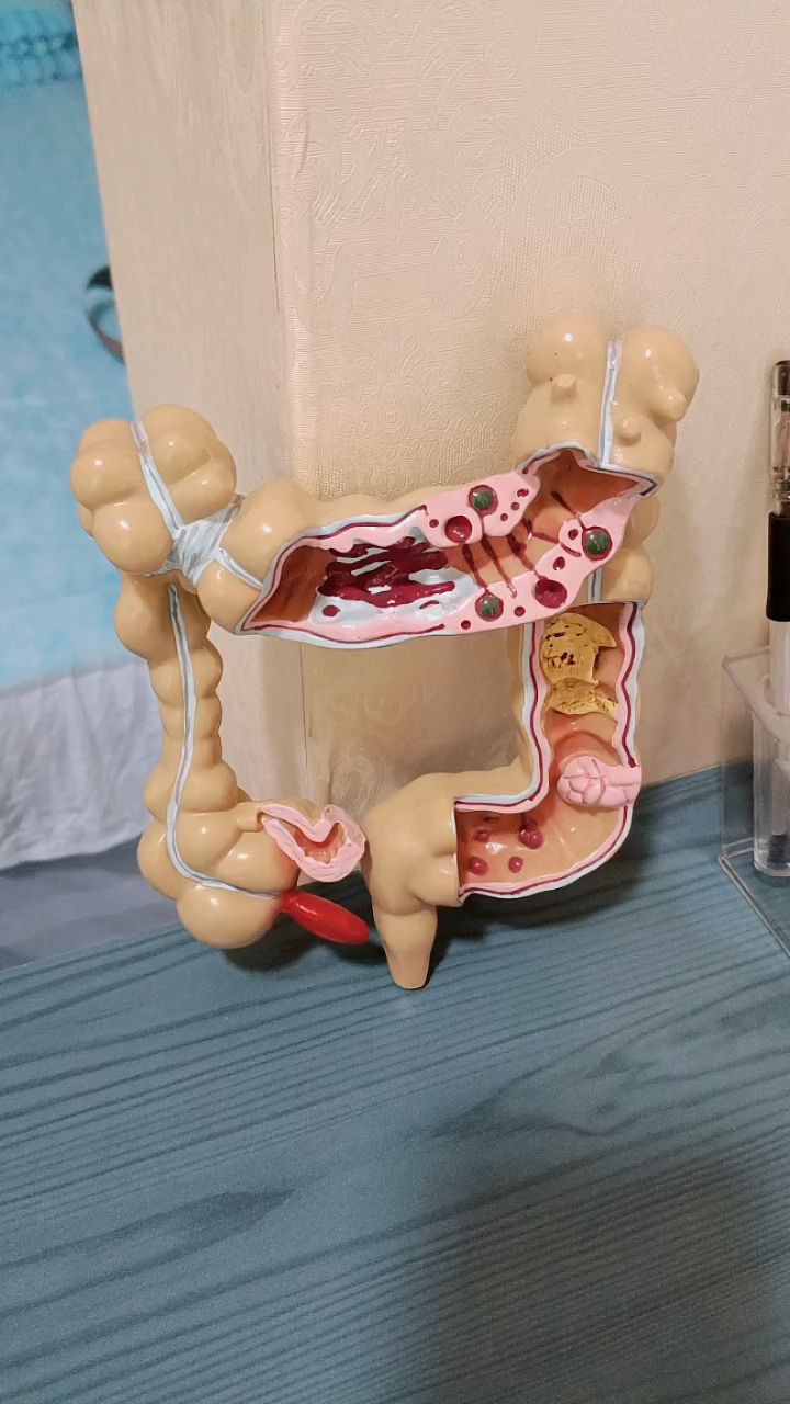 美沙拉嗪要用多久?