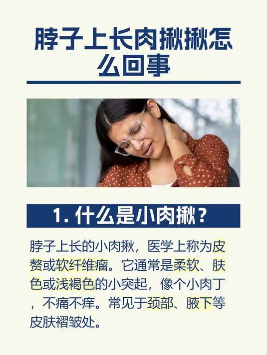 #马上健康过大年#脖子上长肉揪揪怎么回事