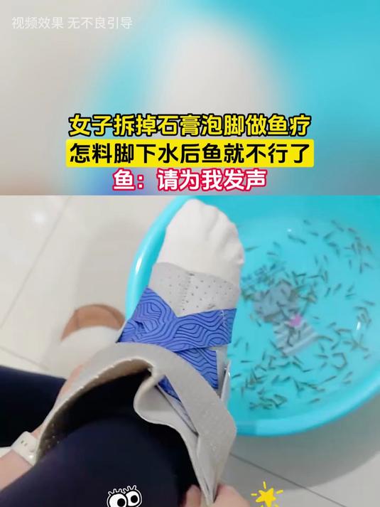 女子拆掉石膏泡脚做鱼疗,怎料脚下水后鱼就不行了,鱼:请为我发声