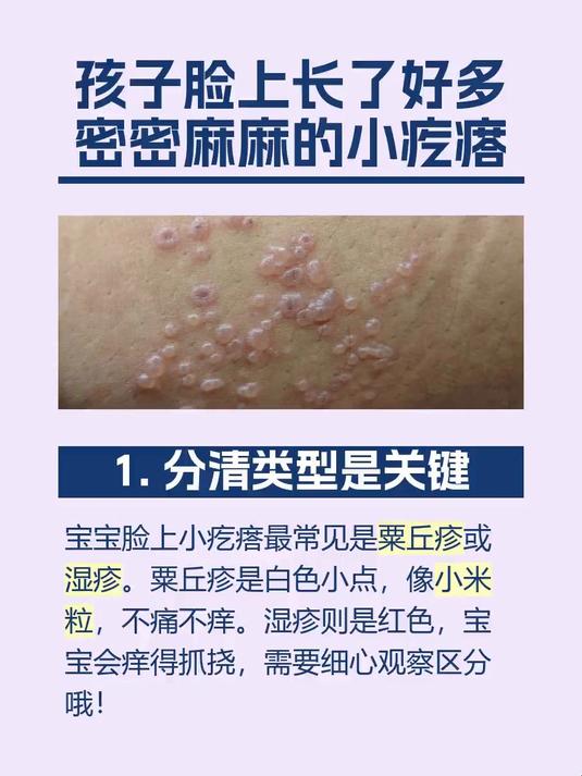 #马上健康过大年#孩子脸上长了好多密密麻麻的小疙瘩
