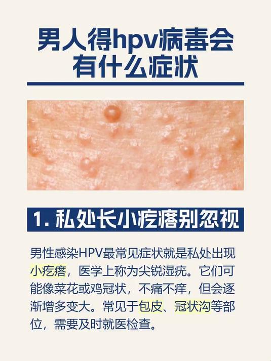 男人得hpv病毒会有什么症状