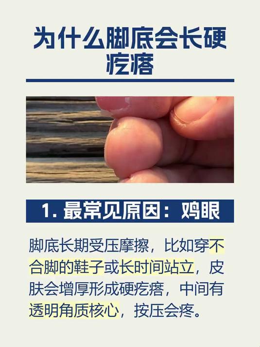 #马上健康过大年#为什么脚底会长硬疙瘩