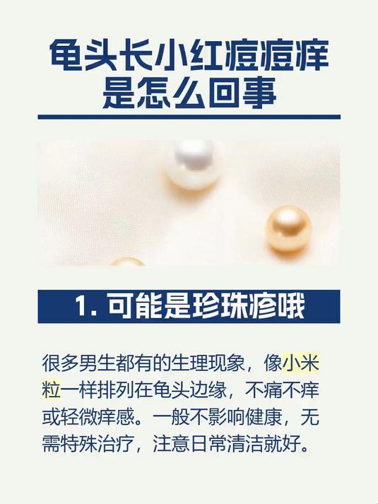 龟头长小红痘痘痒是怎么回事