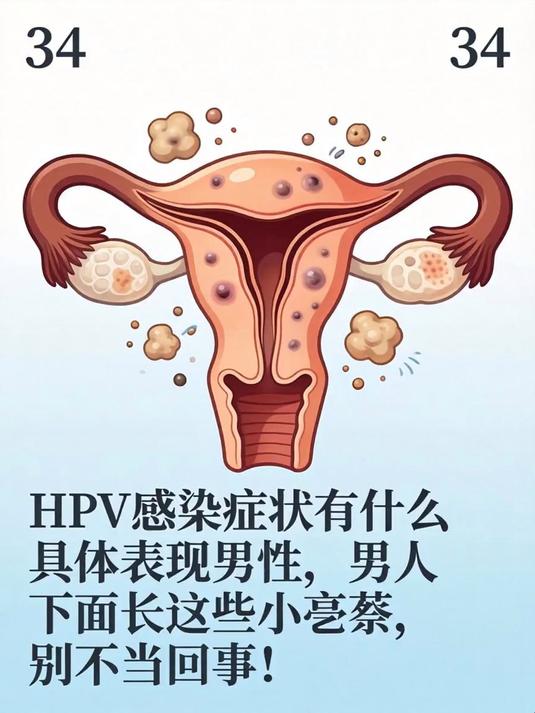 HPV感染症状有什么具体表现男性,男人下面长这些小疙瘩,别不当回事!
