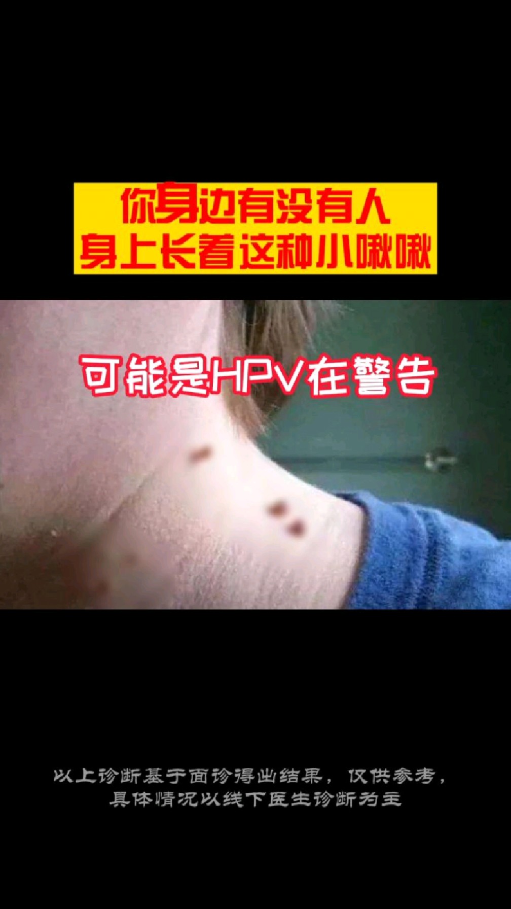 当身上出现这种小肉揪,要注意了!!