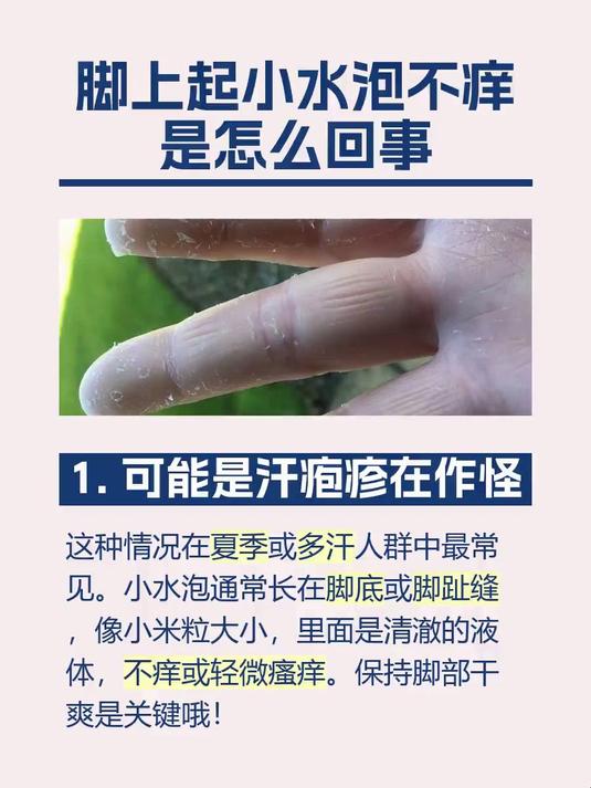 #马上健康过大年#脚上起小水泡不痒是怎么回事