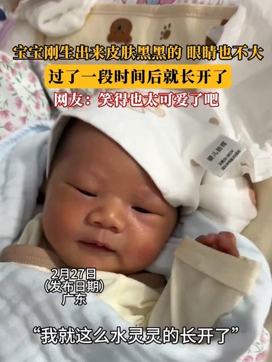 宝宝刚生出来皮肤黑黑的,眼睛也不大,过了一段时间后就长开了
