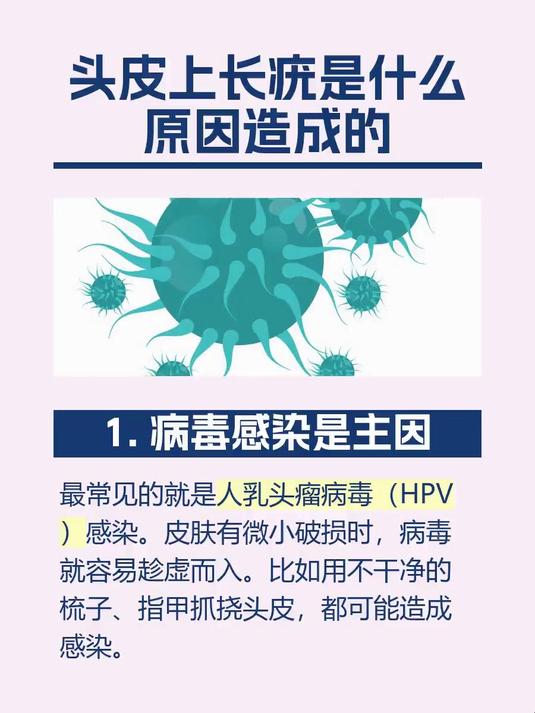 头皮上长疣是什么原因造成的