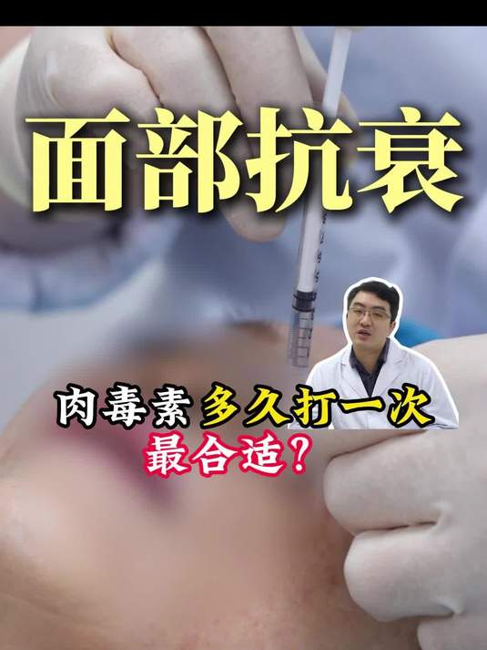 肉毒素多久打一次，最合适？