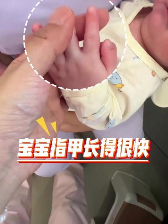 宝宝指甲长得很快,三四天左右就要修剪,不然非常容易划伤自己