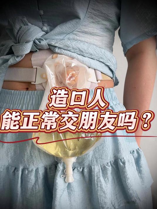造口人能正常交朋友吗?