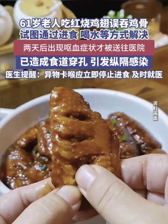 六旬老人吞鸡骨险丧命鸡骨头 卡喉咙怎么办