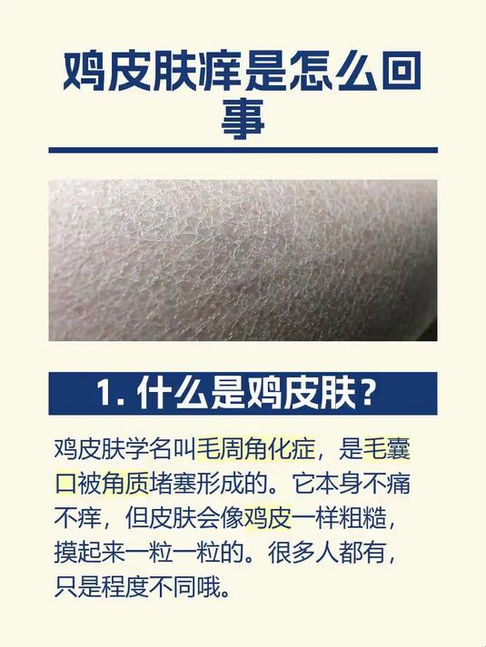 鸡皮肤痒是怎么回事