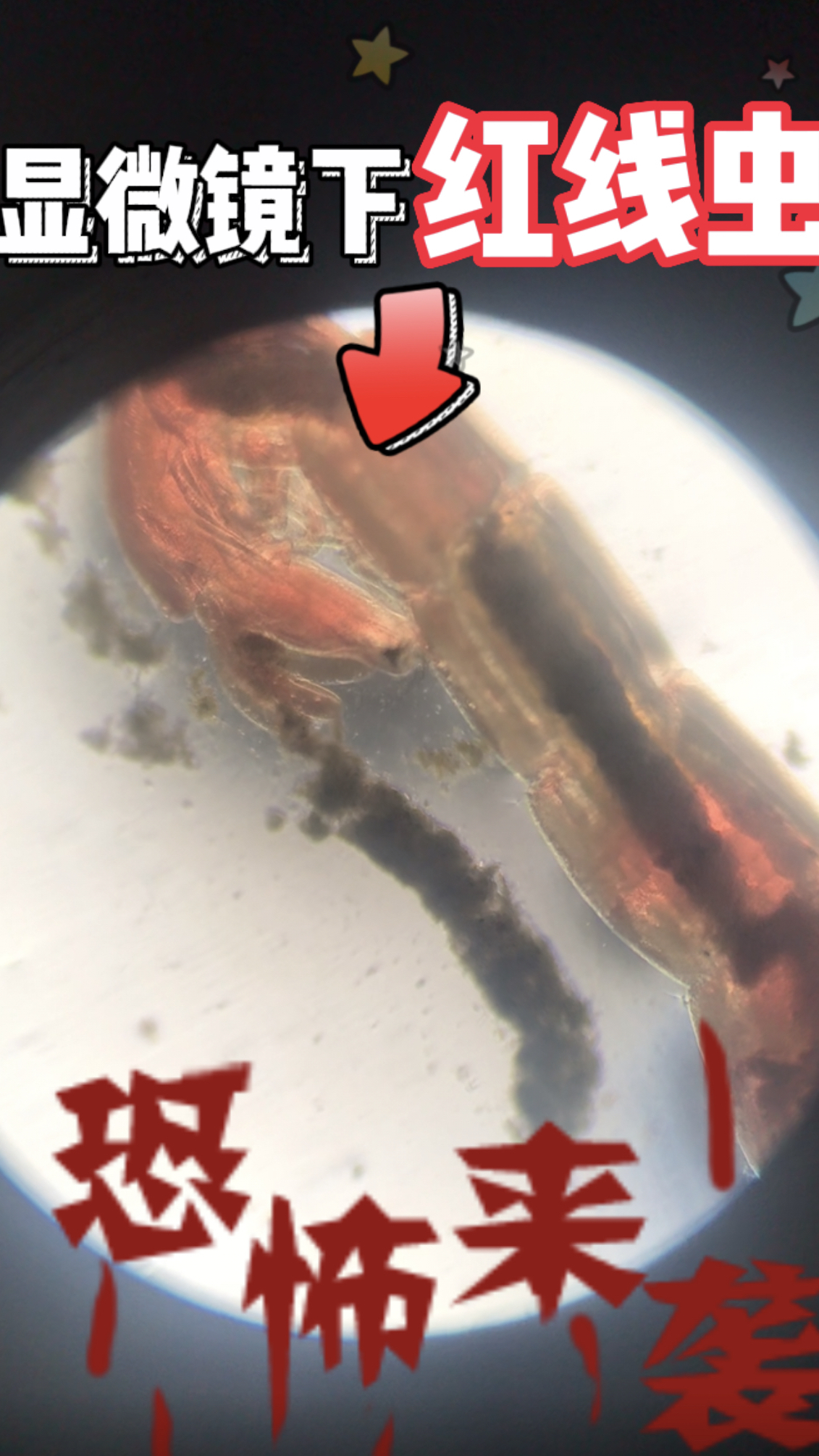 臭水沟的红线虫在显微镜下是这样的!