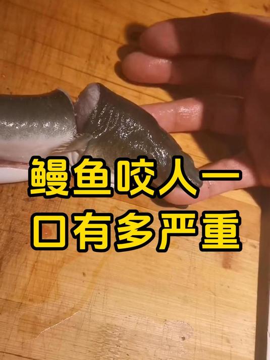 鳗鱼咬人一口有多严重,被鳗鱼咬过才知道有多疼