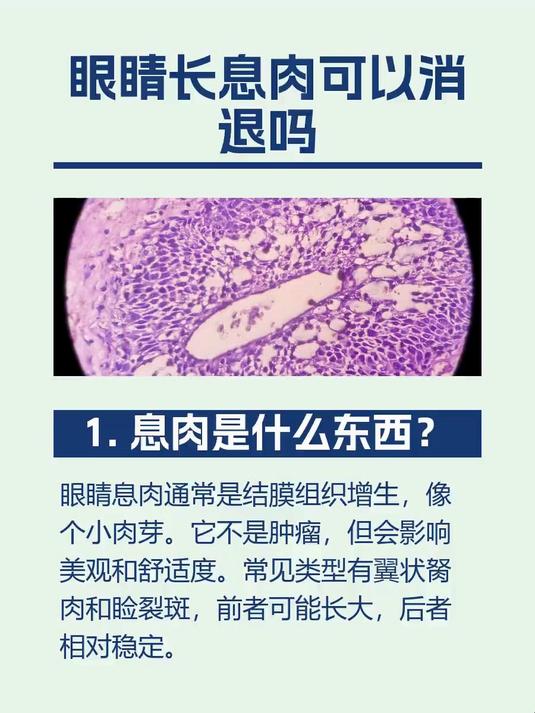 眼睛长息肉可以消退吗