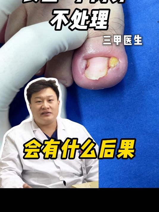 长出小肉芽不处理会有什么后果