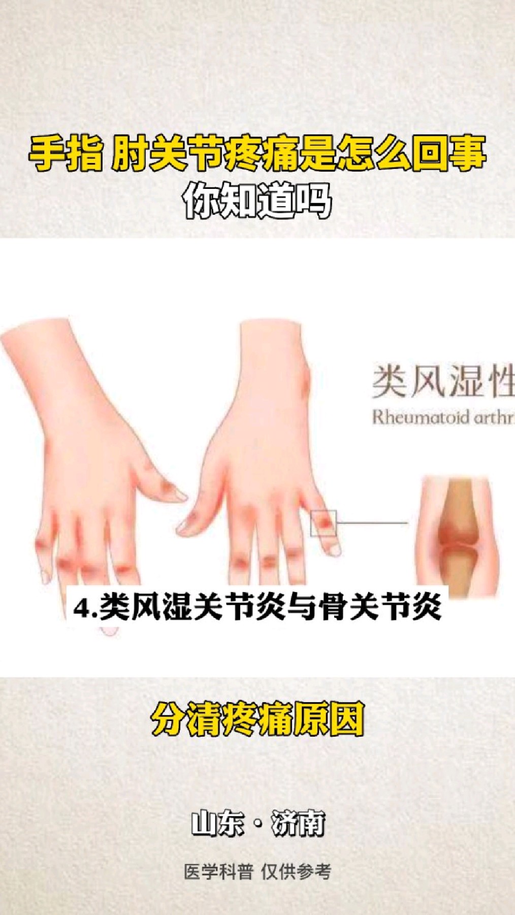 手指 肘关节疼痛是怎么回事,你知道吗?