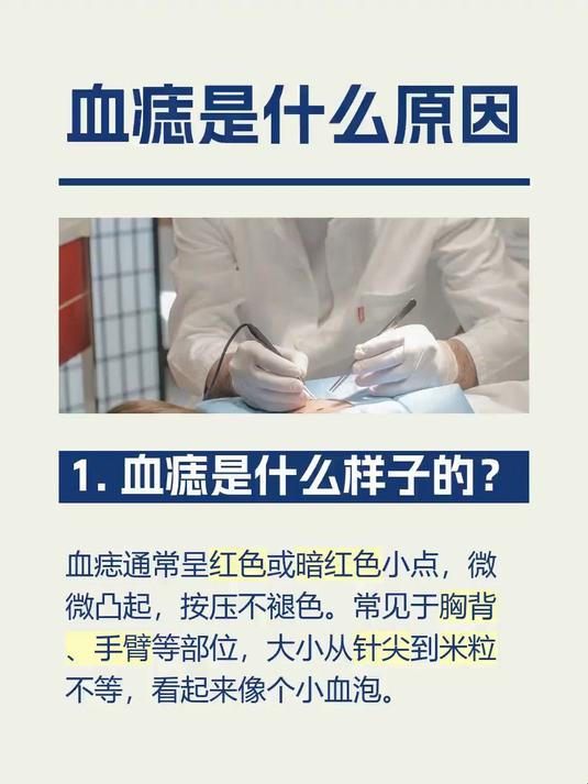 #马上健康过大年#血痣是什么原因