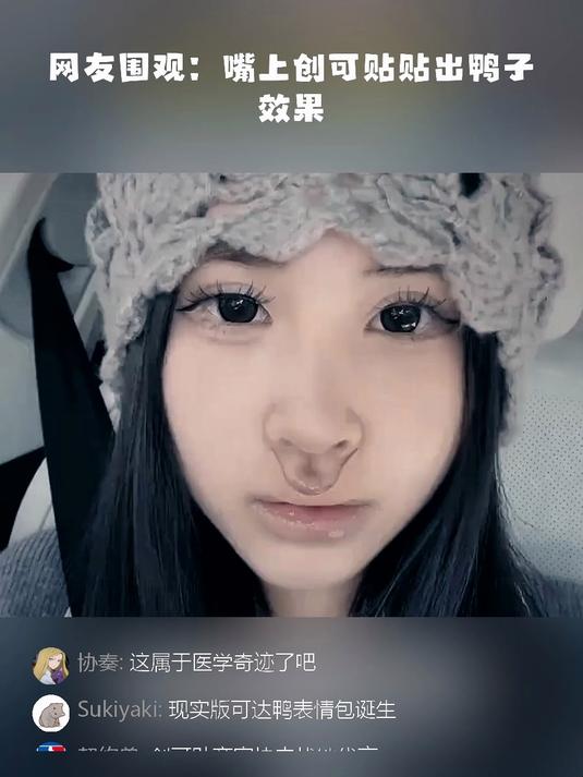女子嘴受伤粘了创可贴,结果变得跟鸭子一样,网友:看半天才发现创可贴位置 #健康扬帆季#7